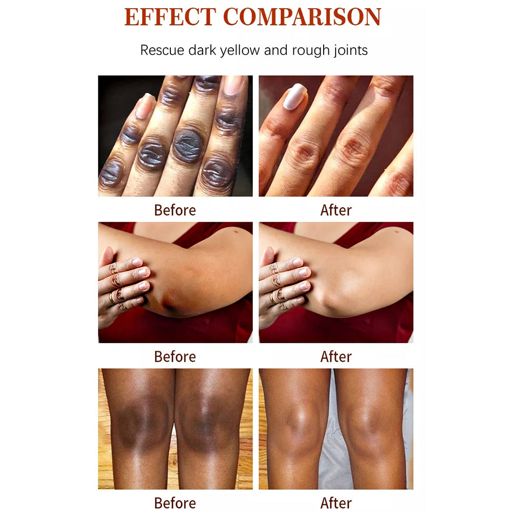 Korean Natural Vegan Facial Dark Spot Remover w Vitamin C