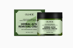 Herbal Acne Cream