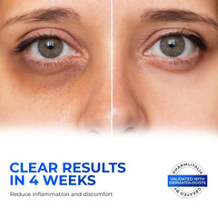 Retinol Under-Eye Cream for Puffiness & Bags