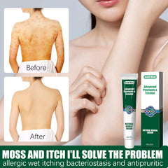 South Moon Herbal Cream for Moisturizing & Itch Relief