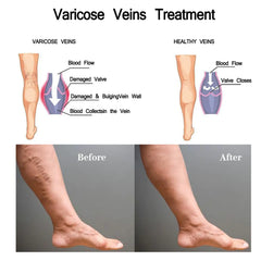 South Moon Herbal Patches for Leg Pain Relief