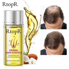 RtopR Herbal Hair Oil for Hair Growth & Nourishment
