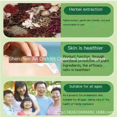 Herbal Itch Relief Ointment for Insect Bites