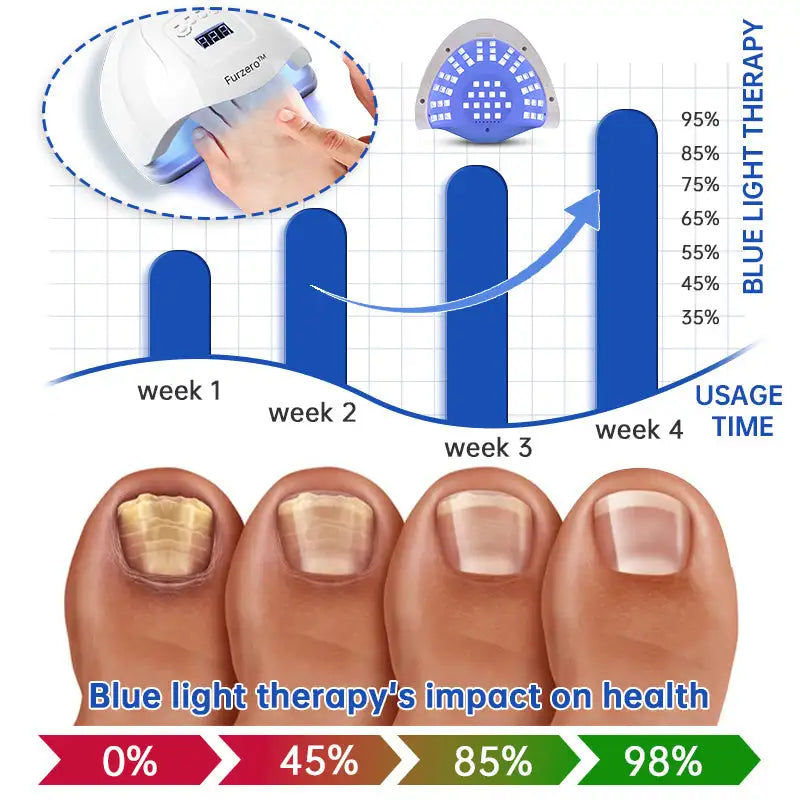 Nail Fungus Laser Therapy Device